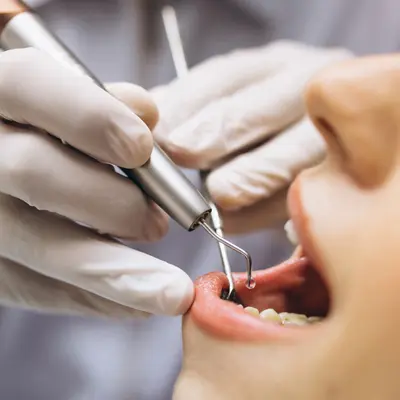 um dentista usando ferramentas em uma boca